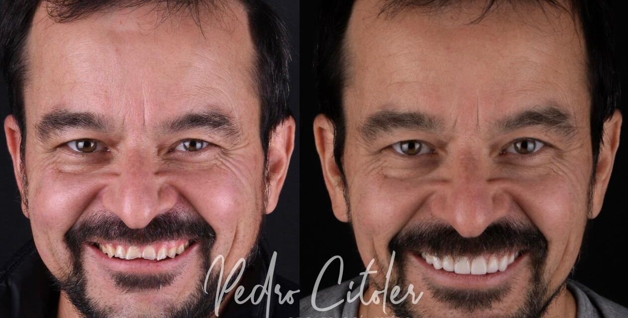 Rehabilitar no es cubrir, es devolver identidad