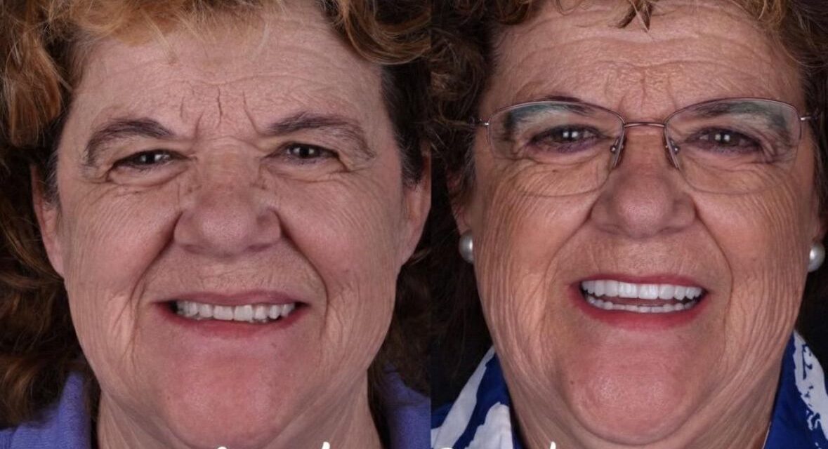 La estética dental transforma calidad de vida y autoestima