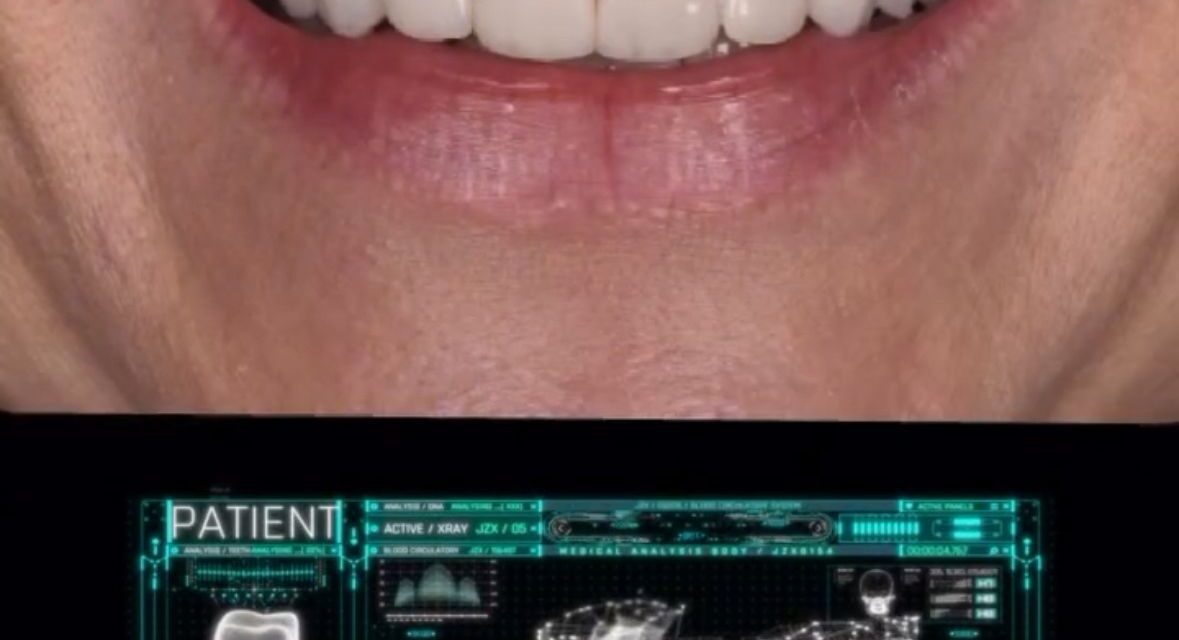 Cuando la estética dental, cambia vidas.