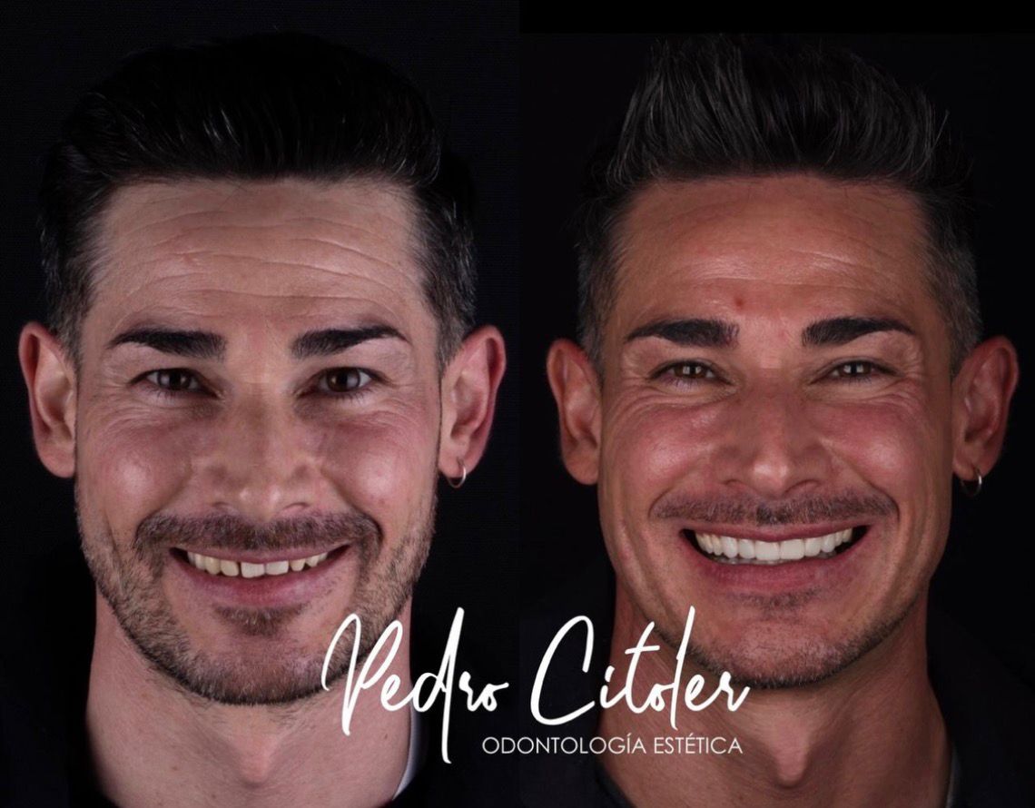 Estética dental - Pedro Citoler