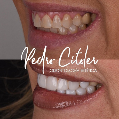 La decisión más importante antes de empezar un tratamiento dental (y casi nadie la tiene en cuenta)