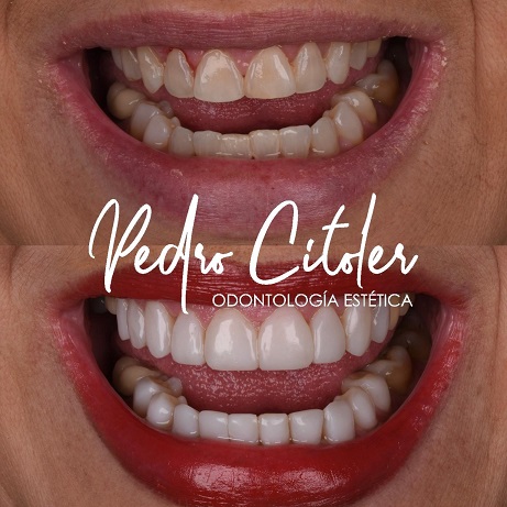 Qué tienen en común las clínicas dentales de referencia en España