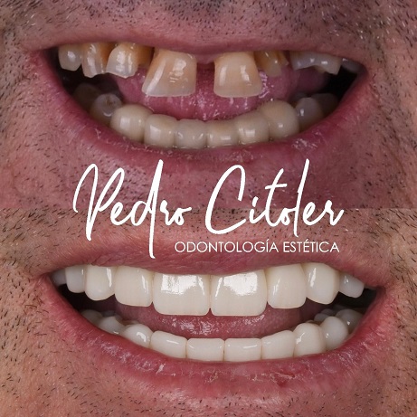 Por qué la planificación es un factor clave en odontología moderna