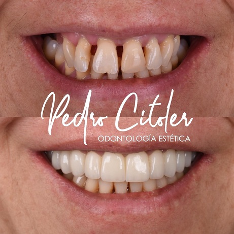 Más allá del resultado: cómo se construye una sonrisa de alto nivel