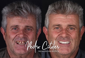 Por qué no todas las clínicas pueden trabajar con resultados predecibles