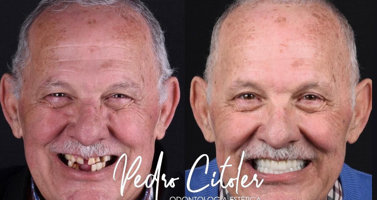 ¿Qué diferencia a una clínica dental reconocida en implantología digital de una clínica convencional?