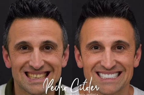 El diagnóstico que cambia una sonrisa comienza mucho antes del tratamiento