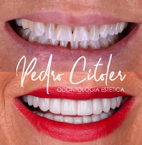 ¿Por qué algunas sonrisas envejecen mejor que otras? La importancia del diseño y la planificación